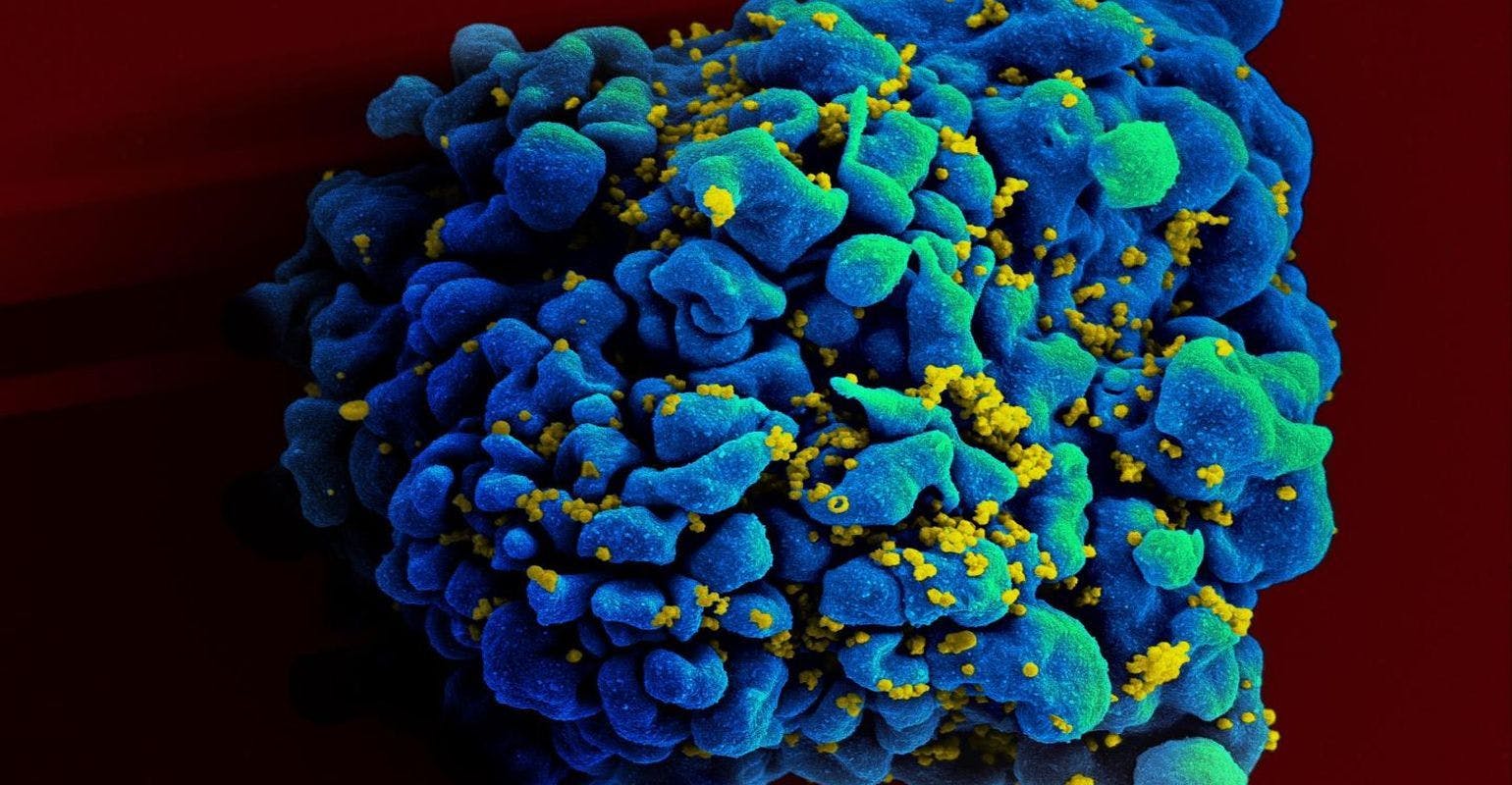NIH HIV Experts Prioritize Research to Achieve Sustained ART-Free HIV Remission