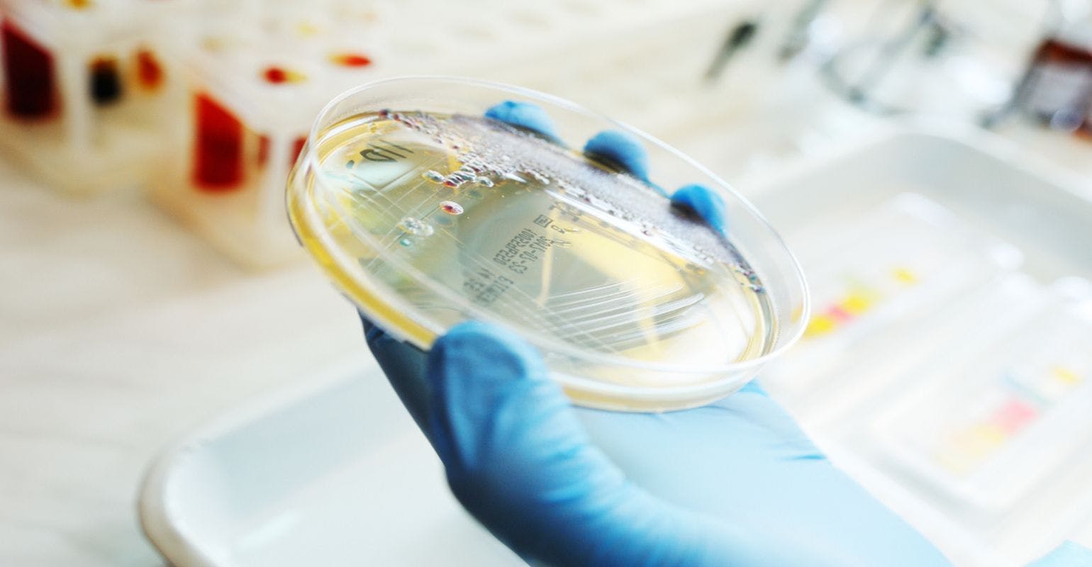 The IP and Microbiology: A Q&A 