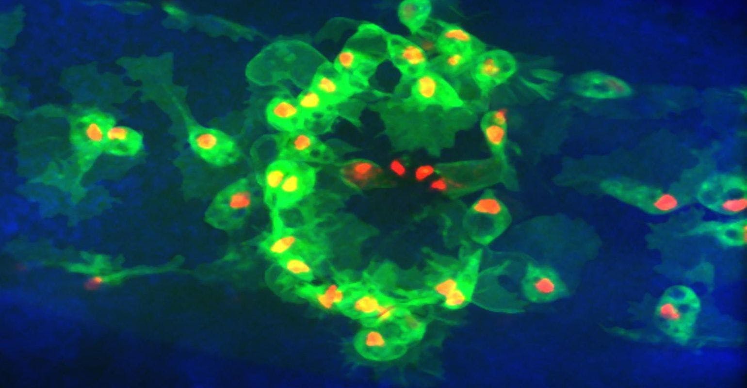 Dead Cells Disrupt How Immune Cells Respond to Wounds and Patrol for Infection