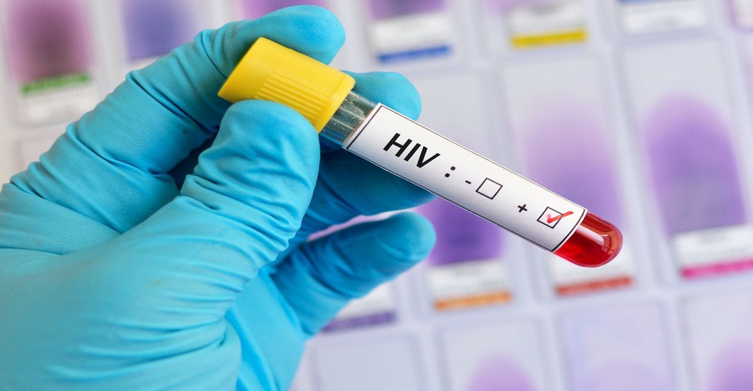 HIV Infections in U.S. Could be Reduced by Up to 67 Percent by 2030, Study Finds