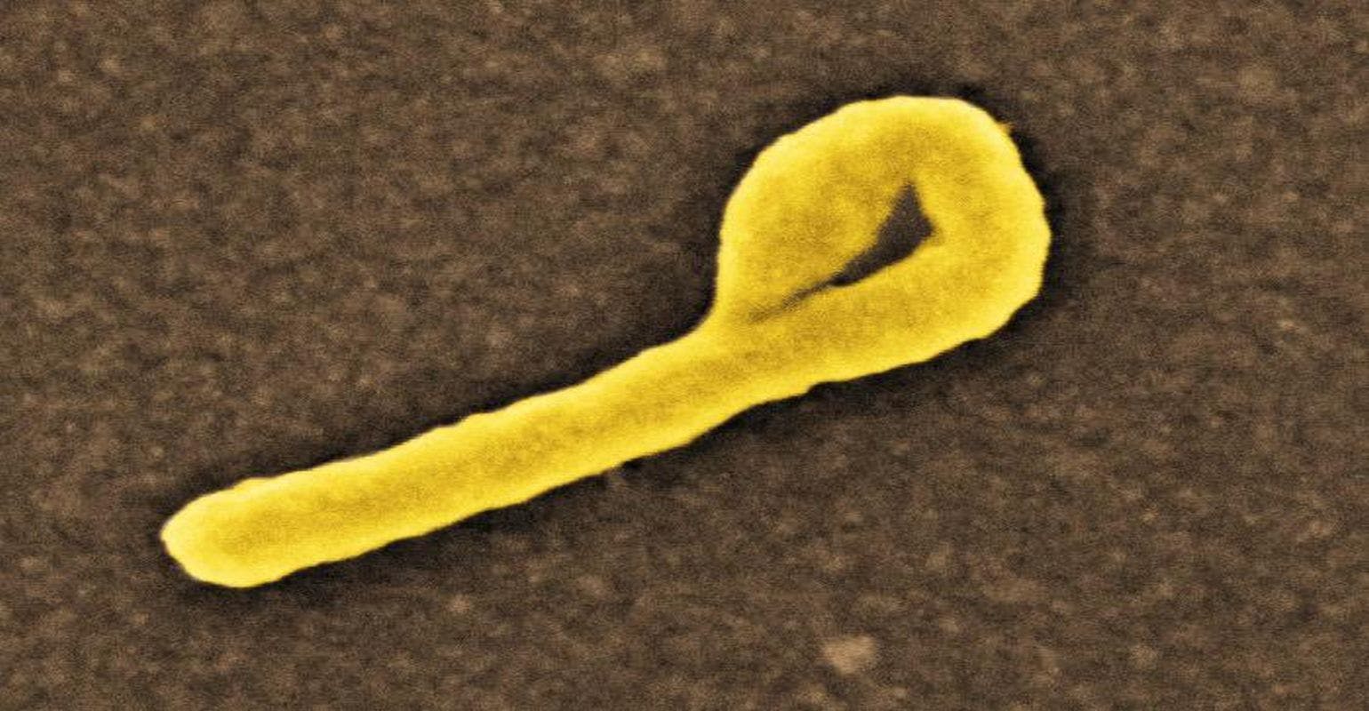 CDC Lab Research Shows Two Treatments Effective Against DRC Ebola Strain