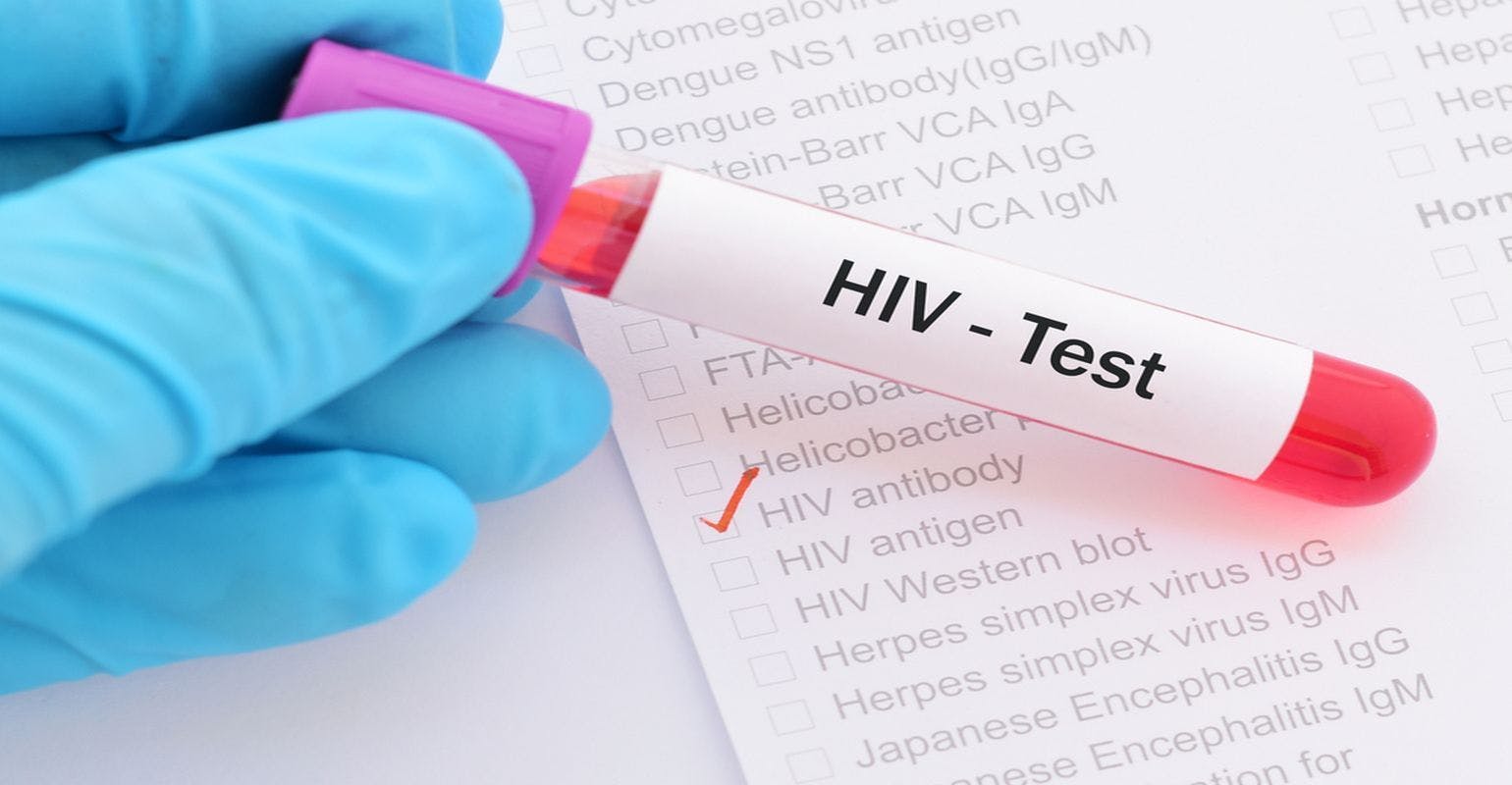 Most Americans Have Never Had an HIV Test, New Data Show