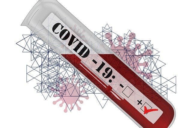 Over-the-Counter, At-Home COVID Test Approved