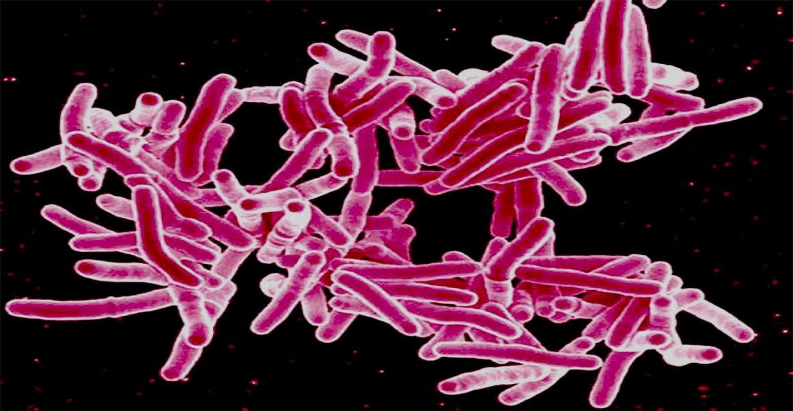 NIH Launches Large TB Prevention Trial for People Exposed to Multidrug-Resistant TB