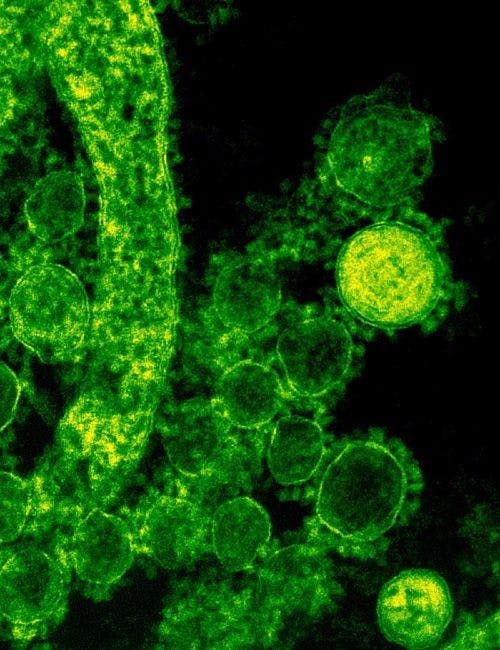 Infection Prevention Efforts for the Novel Coronavirus and Wuhan Outbreak 