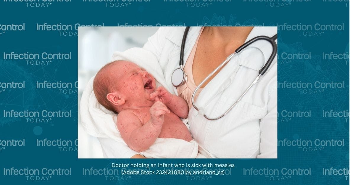 Doctor is holding an infant who is sick with measles. Could this have been prevented? Yes.  (Adobe Stock 232421080 by andriano_cz)