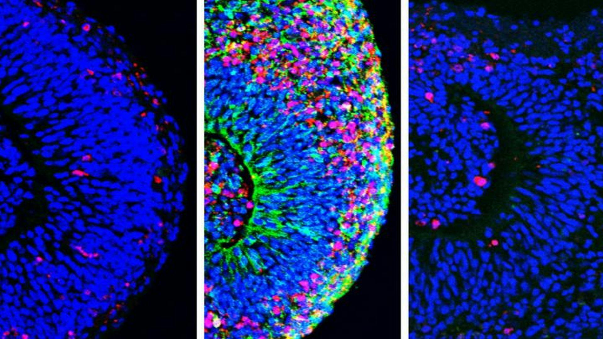 Better Organoids Could Help Scientists Identify Treatments for Zika-Related Brain Damage