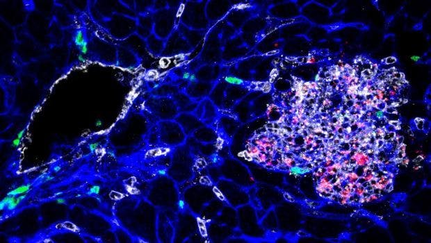 Researchers Study Diverse Pathogenicity of Listeria