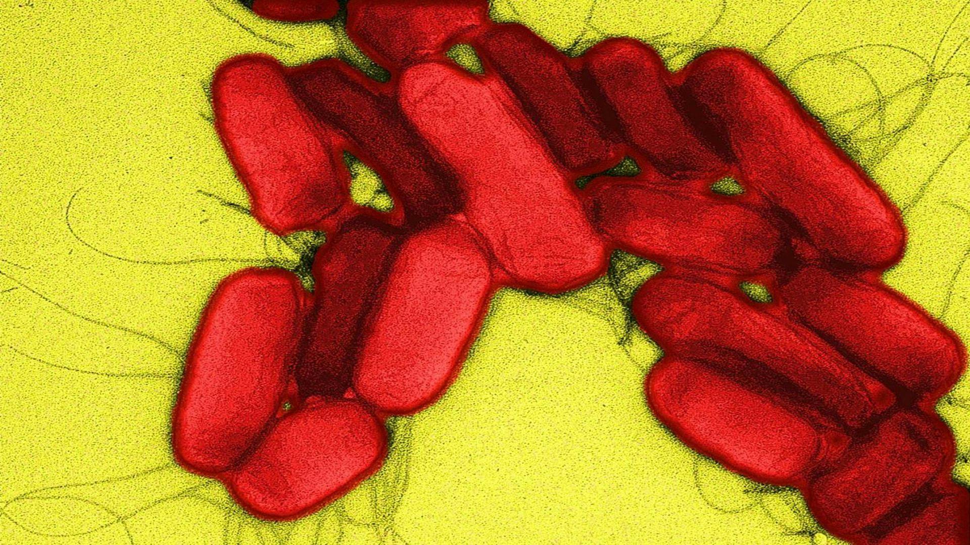 Genome Scientists Use UK Salmonella Cases to Shed Light on African Epidemic