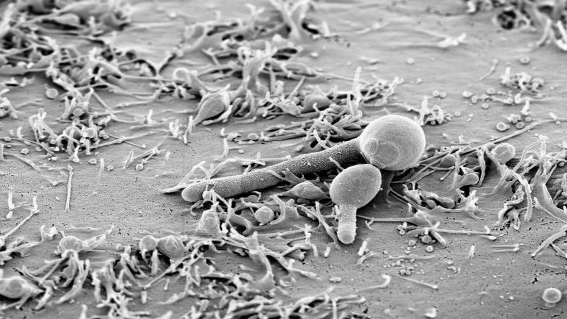 Study Provides Clues to Body's Defense Against Candida albicans