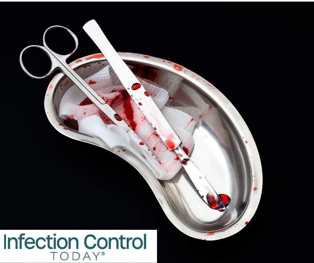 After surgery, bloody medical instruments with a scalpel, cotton swab, surgical scissors, and latex gloves covered in blood in a kidney bowl isolated on a black background.  (Adobe Stock 263186236 by Victor Moussa)