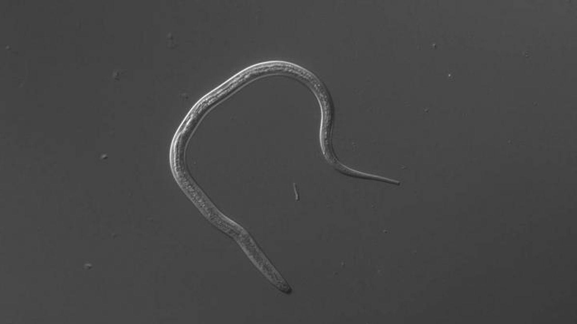 Finding a Lethal Parasite's Vulnerabilities