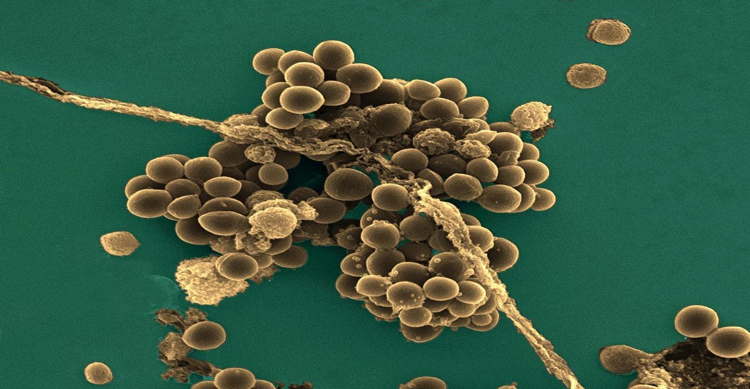Treatment for MRSA No Longer More Costly Than for Susceptible Staph aureus Infections