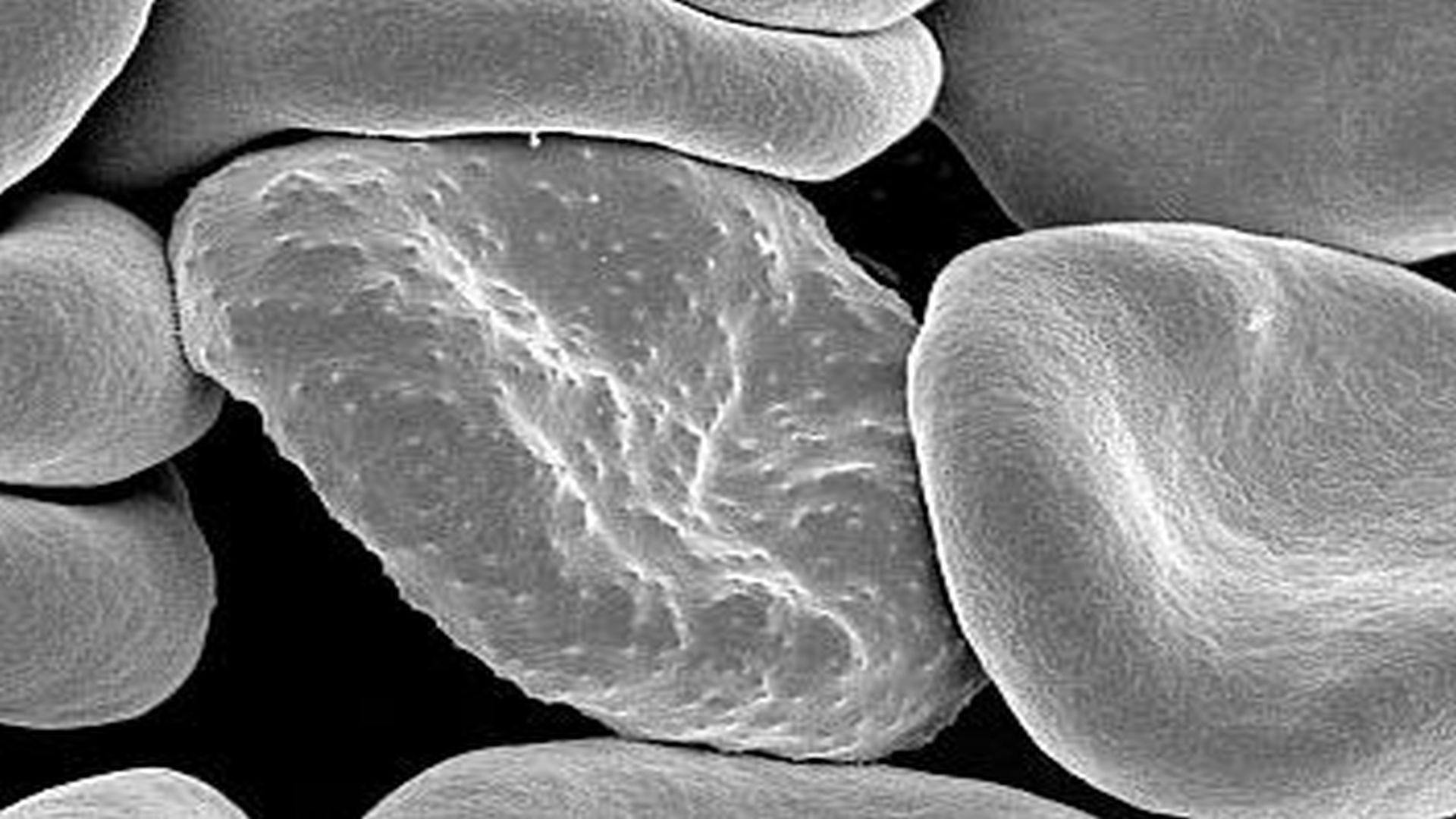 NIH Study Identifies New Targets for Anti-Malaria Drugs