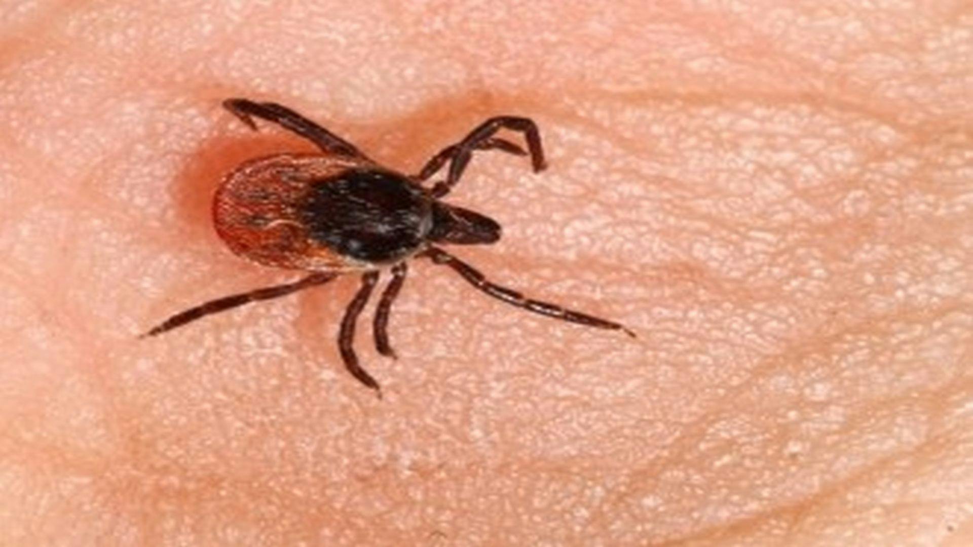 Lyme Study Uses Drug Discovery Methods That Have Fueled Cancer Breakthroughs