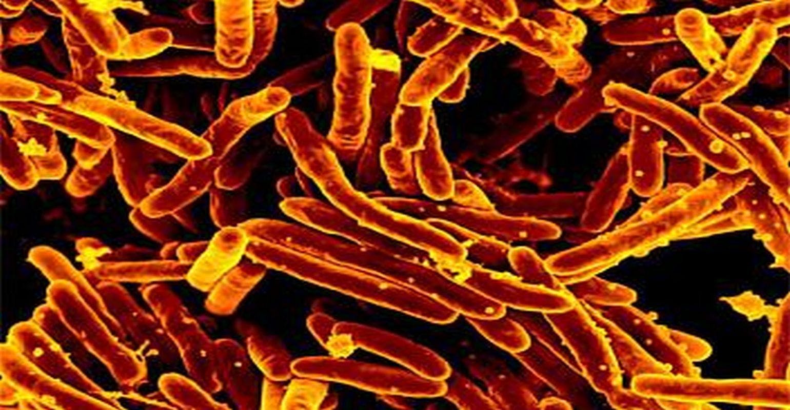 NIAID Releases Strategic Plan to Address Tuberculosis Research