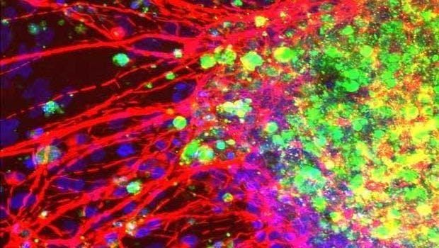 Zika Infects Neural Cells Related to Skull Formation, Affecting Their Function