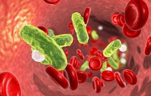 Path to Sepsis Varies by Bacterial Infection
