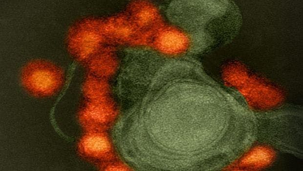 Zika Virus Spread Undetected for Many Months, NIH-Supported Study Finds