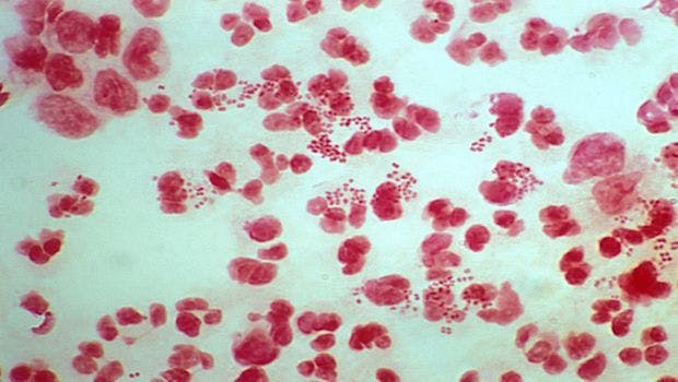 Scientists Develop New Antibiotic for Gonorrhea