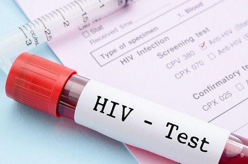 Mailing Free HIV Tests to Homes Seems a Better Approach to Detection Than Usual Care