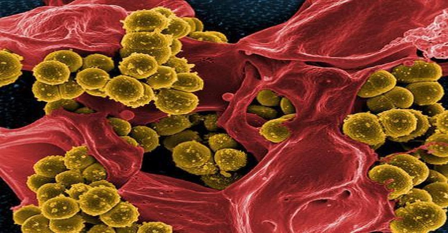Understanding Antibiotic Resistance in Patients With Cystic Fibrosis