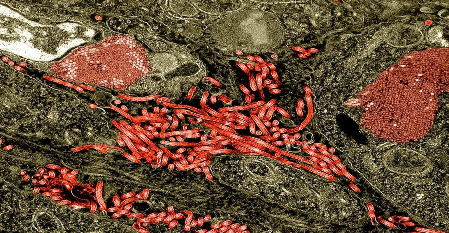 Ebola Virus Infects Reproductive Organs