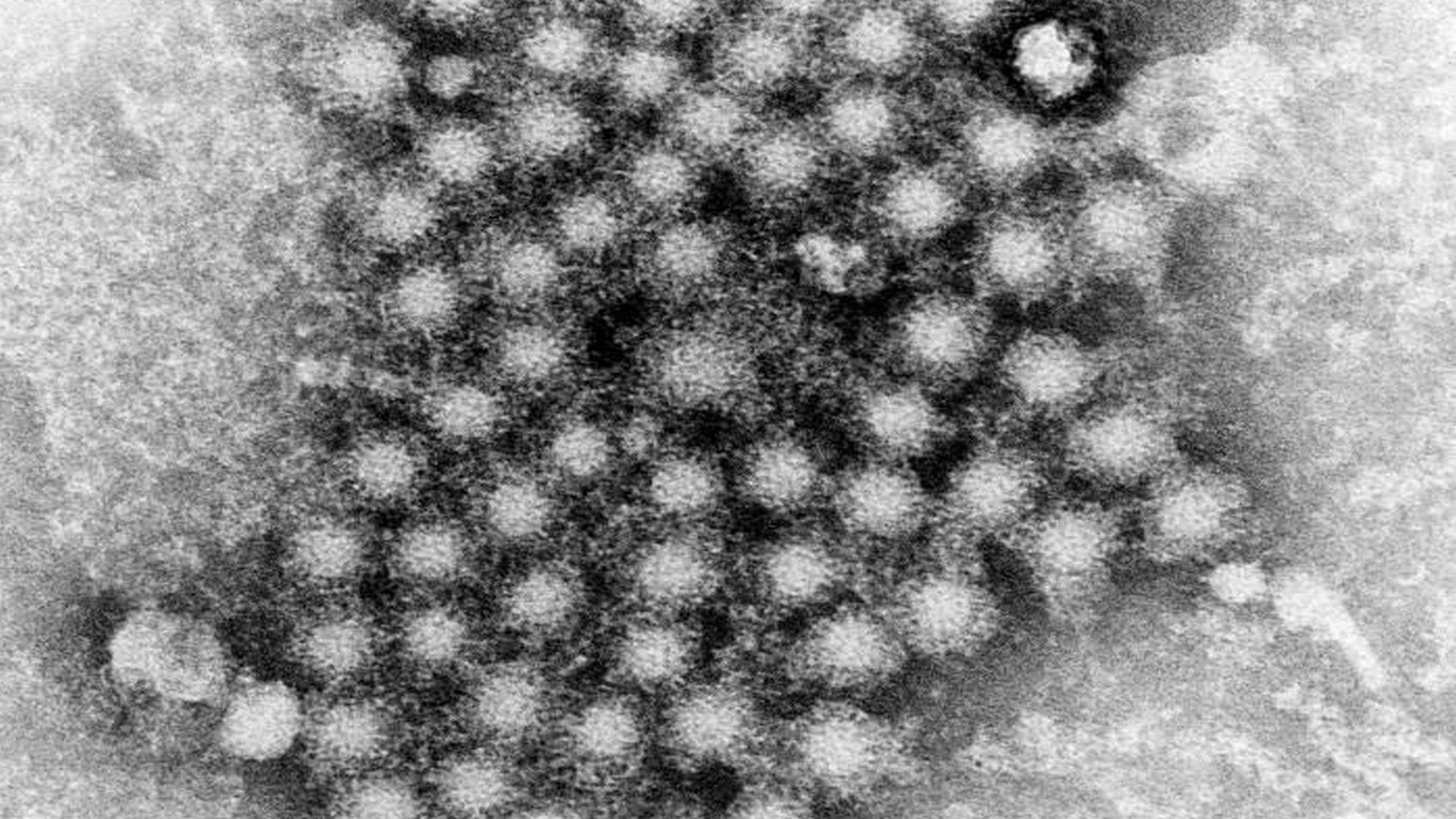 Researchers Identify How Class of Drugs Blocks Hepatitis C Virus Replication
