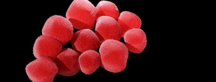 Staphylococcus aureus bacteremia.