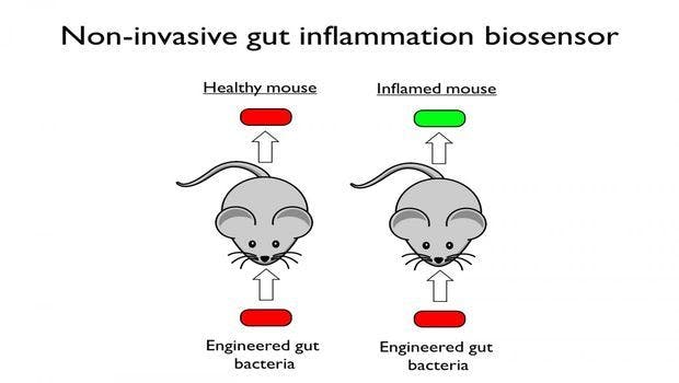 Biologists Engineer Inflammation-Sensing Gut Bacteria
