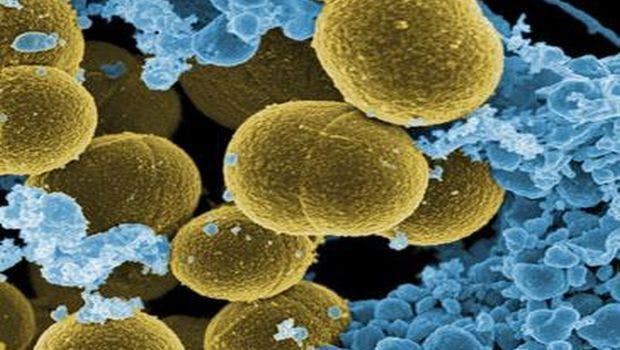 Distinguishing Deadly Staph Bacteria From Harmless Strains