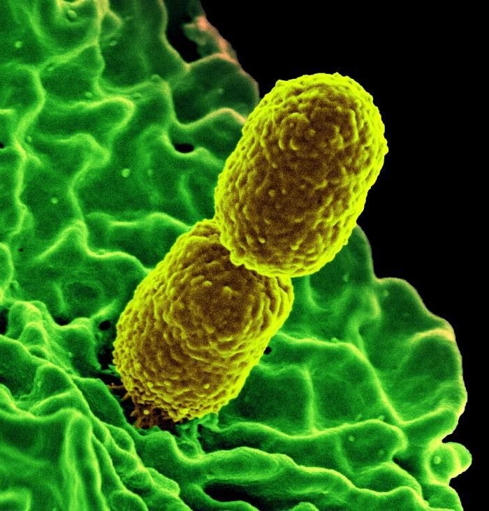 Nurses Most Likely to Spread Microbes, Says Study