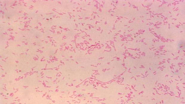 Investigators Identify Optimal Conditions for Growth of Legionella Bacteria