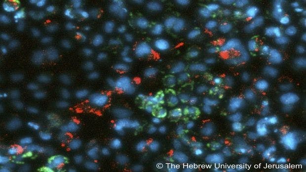 Scientists Find New Metabolic Pathways to Resist Viruses
