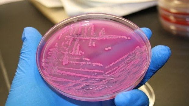 Stool Microbes Predict Advanced Liver Disease