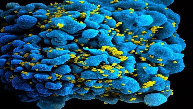 Cell Particles May Help Spread HIV Infection