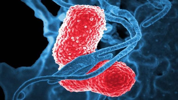 Study Shows How Pneumonia-Causing Bacteria Invade the Body
