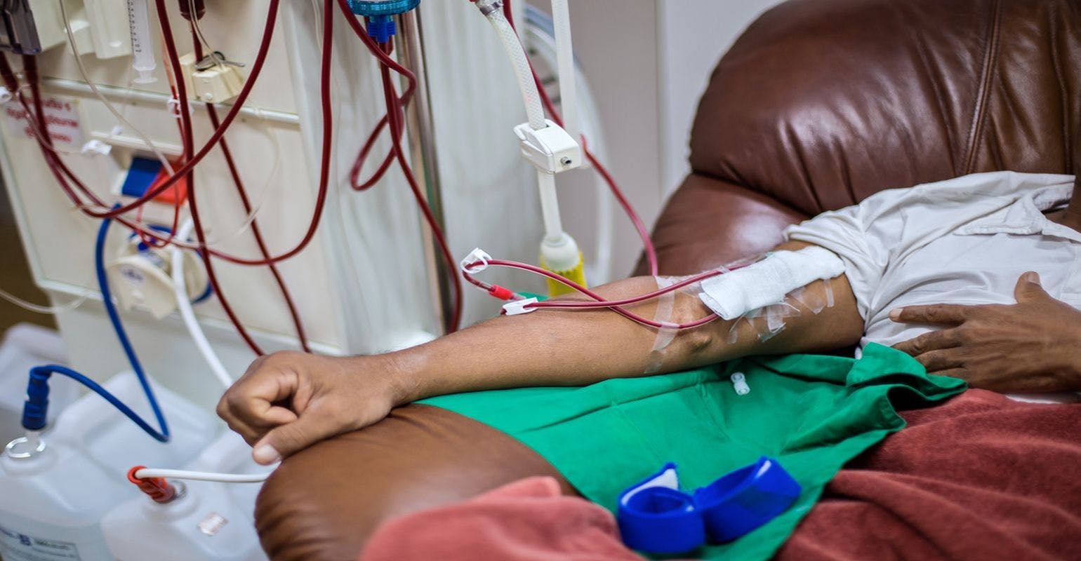 Bloodstream Infection Rates as a Measure of Quality in Hemodialysis Facilities
