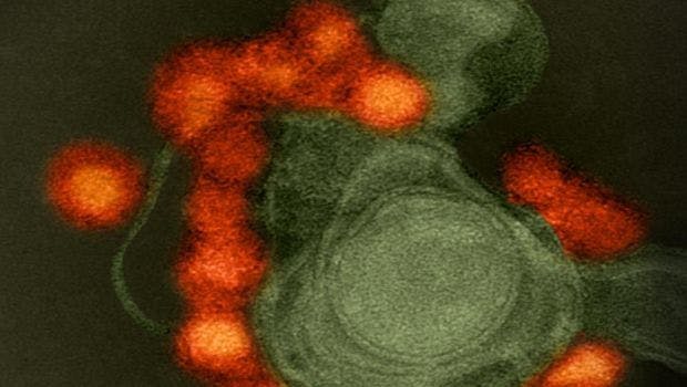 Zika Virus Protein Could Be Vaccine Target
