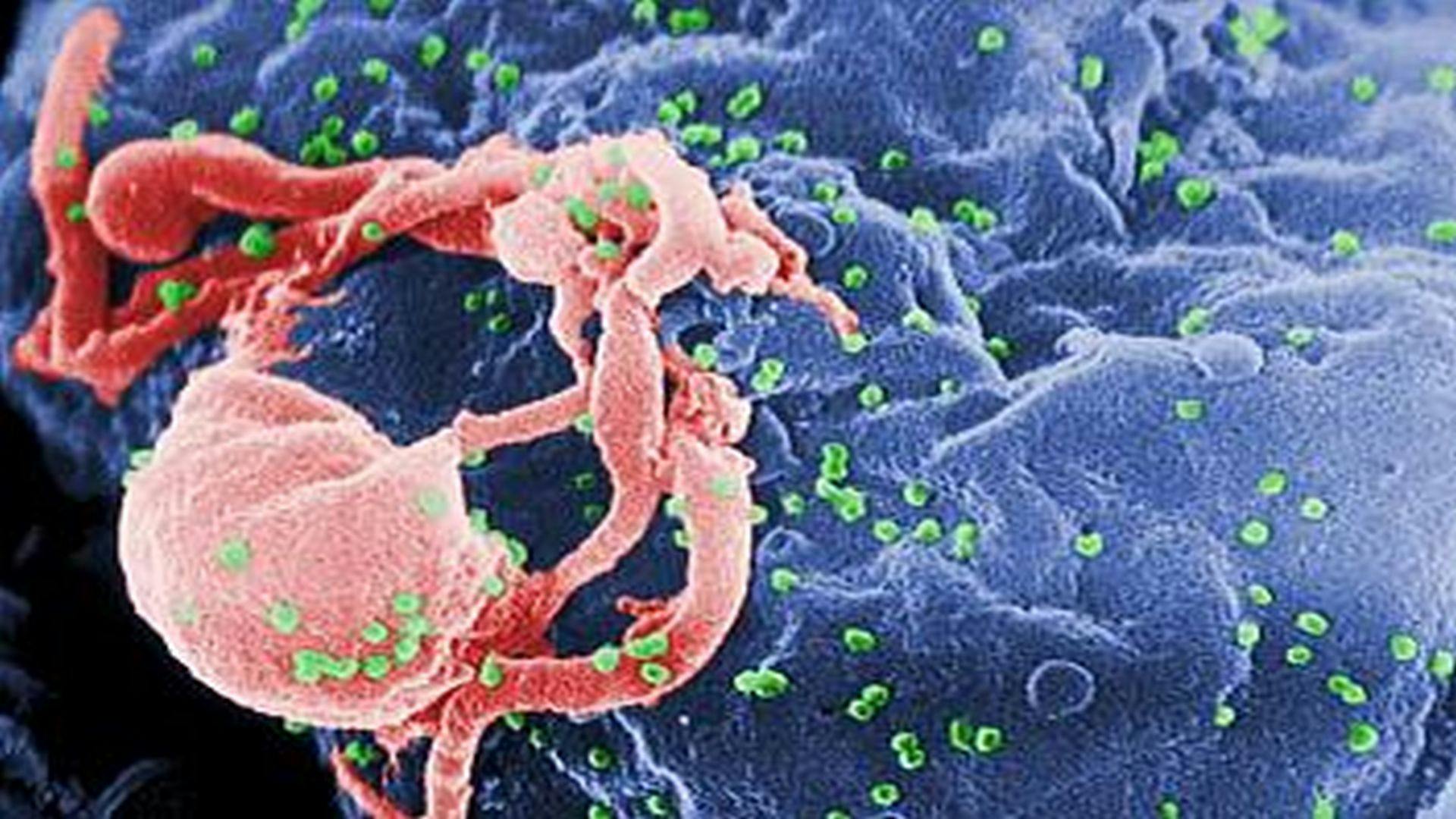 Child Living With HIV Maintains Remission Without Drugs Since 2008