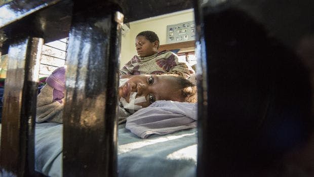 Fighting the Stigma of a Spinal Tap for Malaria Patients