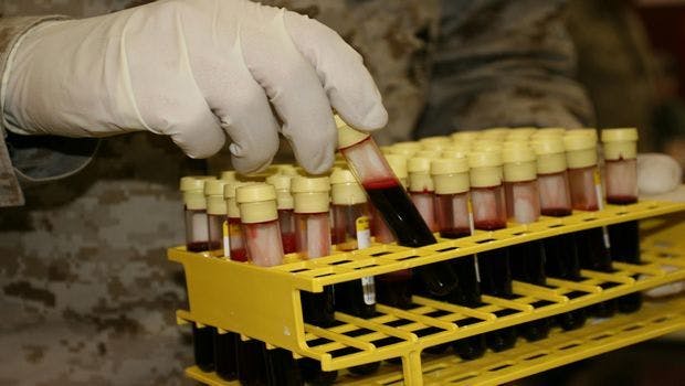 Cholera Toxin More Potent in People With Most Common Blood Type