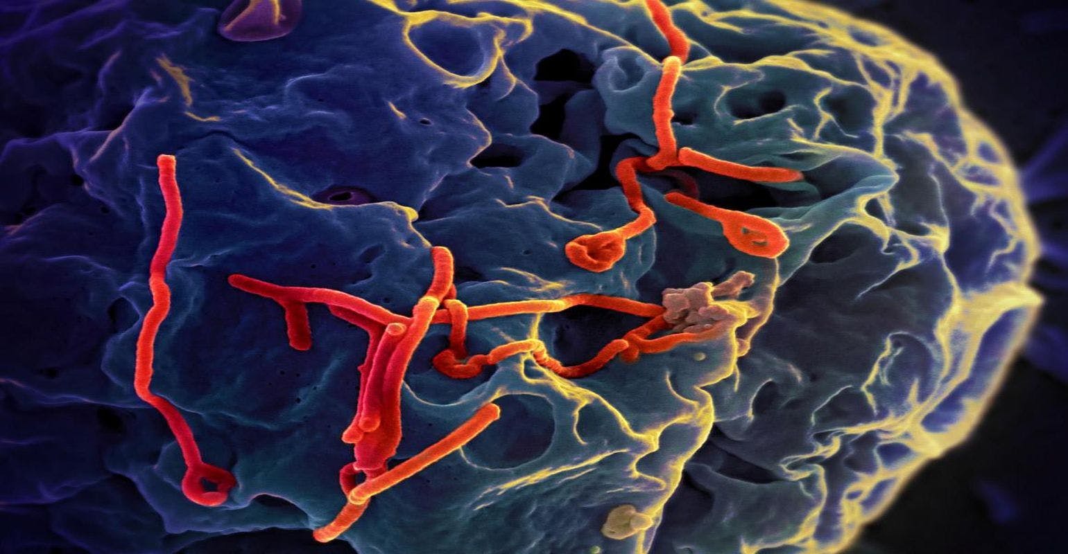 Proteins Found in Semen Increase the Spread of Ebola Virus Infection