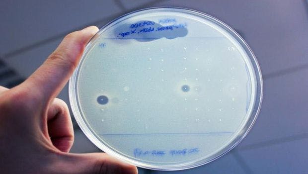 Researchers Discover New Antibiotics by Sifting Through the Human Microbiome