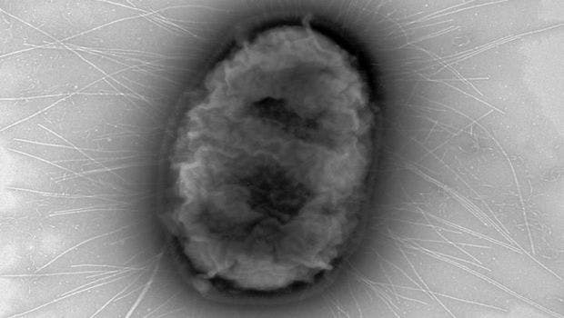 Pandemic E. coli Strain H30 Cloaks Its Stealth Strategies