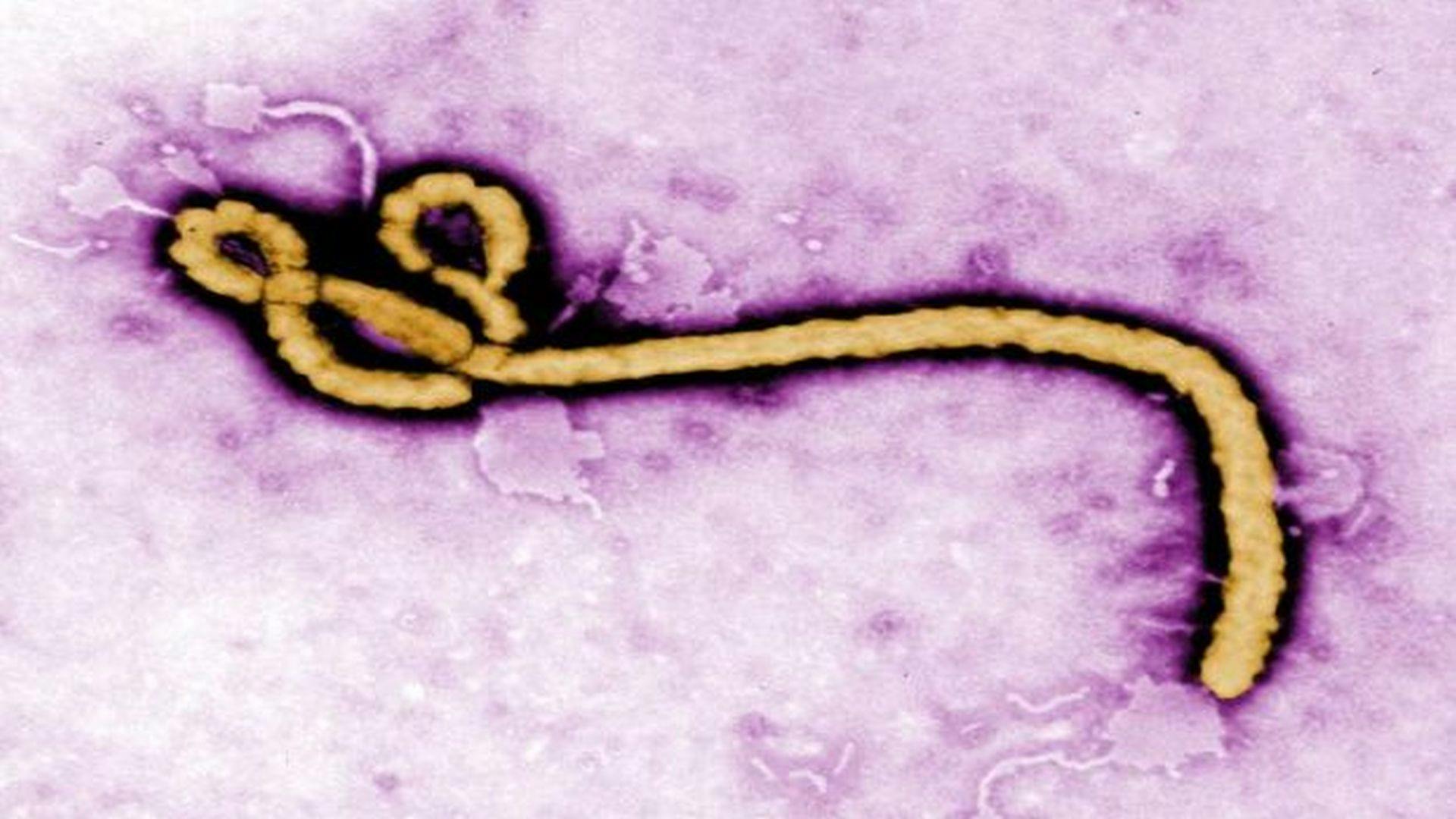 Ebola Detected in Semen of Survivors Two Years After Infection