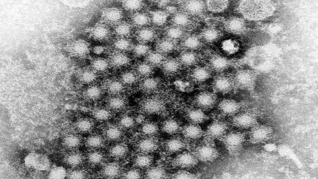 Testing for Hepatitis C Virus Remains Low Among Baby Boomers