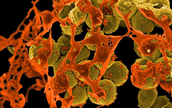 FDA Announces Strategic Approach for Combating Antimicrobial Resistance