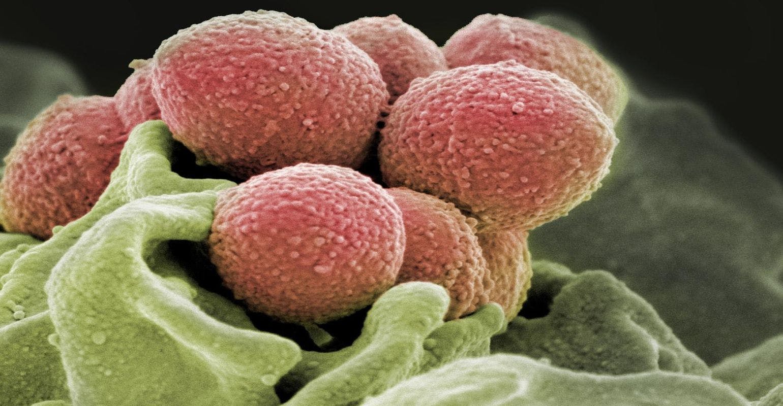 Researchers Find Trigger That Turns Strep Infections Into Flesh-Eating Disease