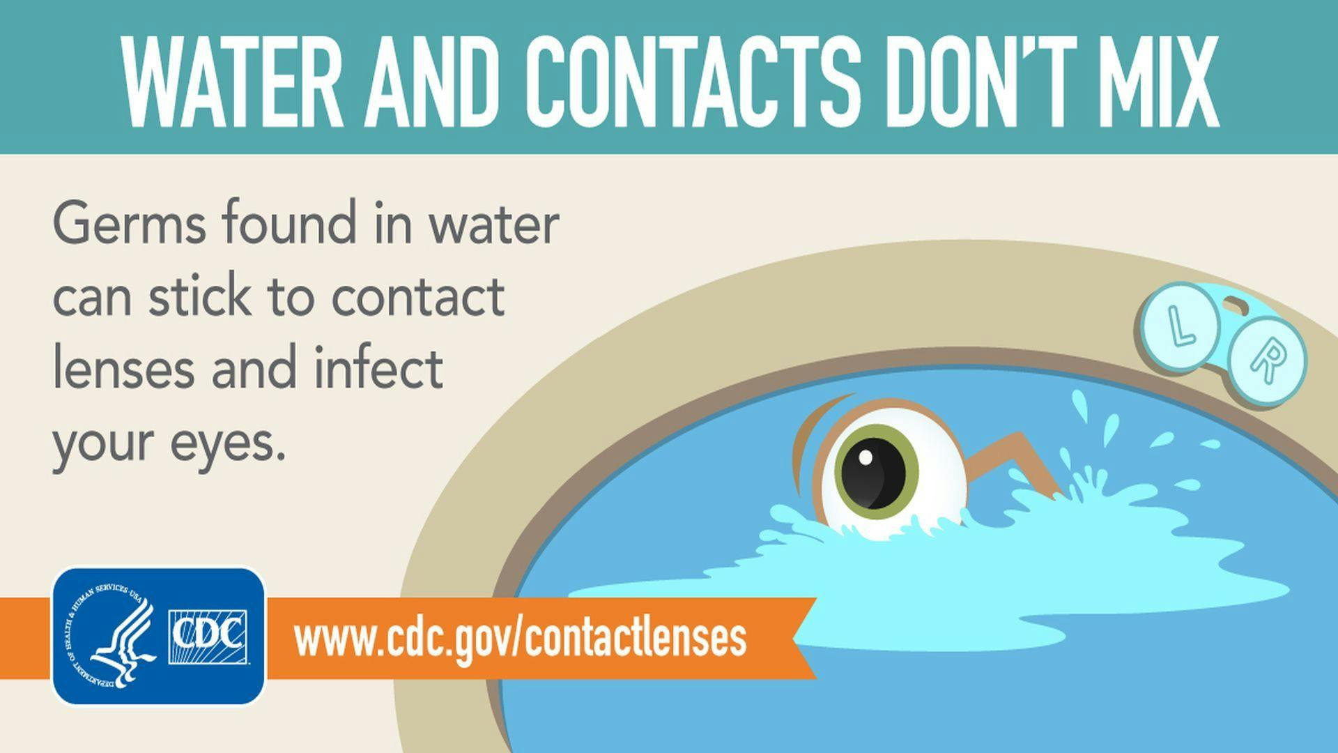 Most Adolescent Contact Lens Wearers Report Habits That Could Cause Eye Infection